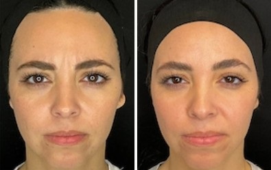 Mystique Medical Spa