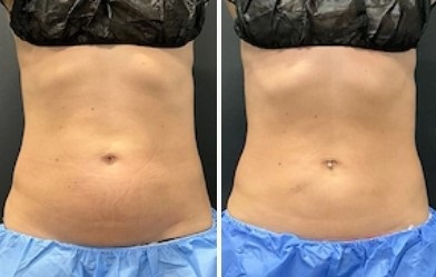 Mystique Medical Spa